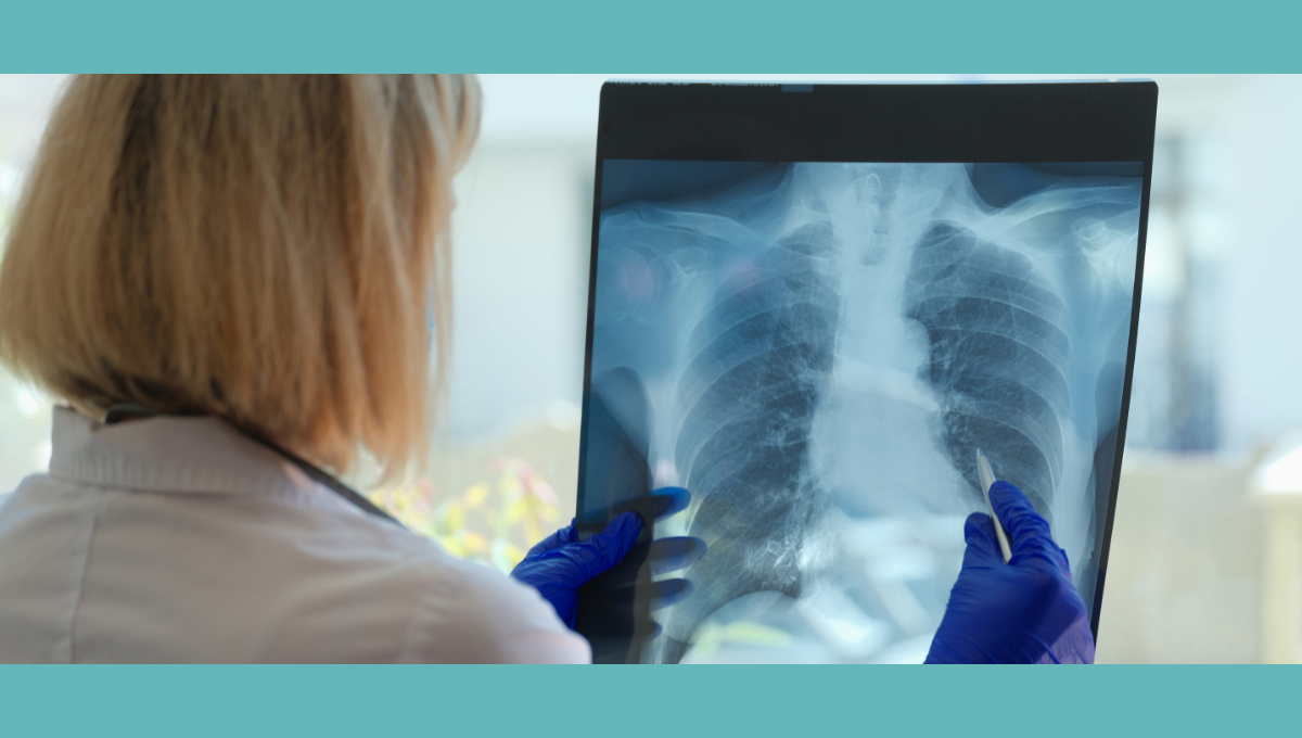 Curso de actualización de Cuidado Respiratorio
